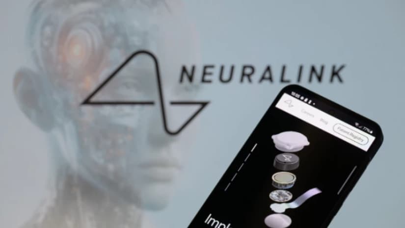 ილონ მასკი 2026 წელს ტვინის ჩიპების მასიურ წარმოებას გეგმავს