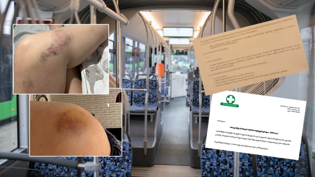 მენჯის, მალის, ნეკნის მოტეხილობა - თბილისის ავტობუსებში დაზარალებულები