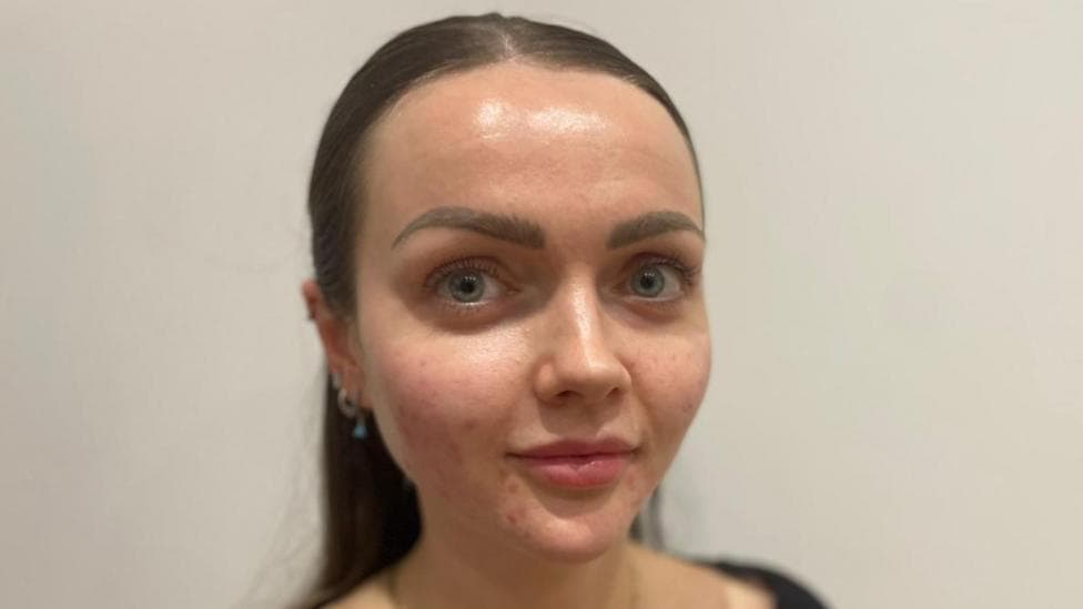 Move over fillers - here's why people are having facial injections made from fish sperm