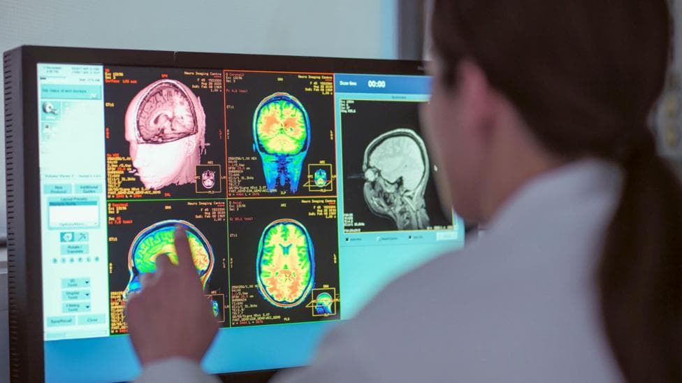 Adolescence lasts into 30s - new study shows four pivotal ages for your brain