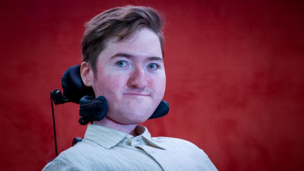 Doctors said I might not make my second birthday with muscle disease SMA. Now I'm 25